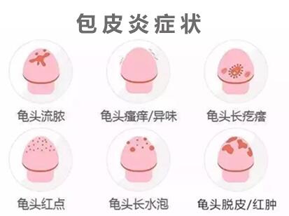 洛阳治疗包皮龟头炎医院哪家好