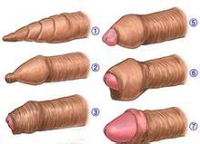 洛阳做包皮手术哪个男科医院比较好